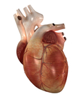 Аортальный стеноз клапана (дефект клапанов сердца) фото