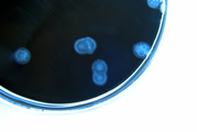 Campylobacter инфекции (Кишечные инфекции бактерии) фото
