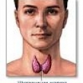 Болезни щитовидной железы, связанные с йодной недостаточностью