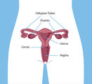 Рак шейки матки (опухоли) фото