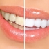 Зубные отложения