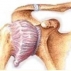 Адгезивный капсулит плеча