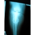 Хирургии коленного сустава изменений фото