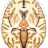 Ученые выявили причину наследственного заболевания головного мозга