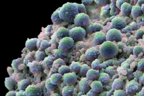 Исследован ген раковых клеток предстательной железы